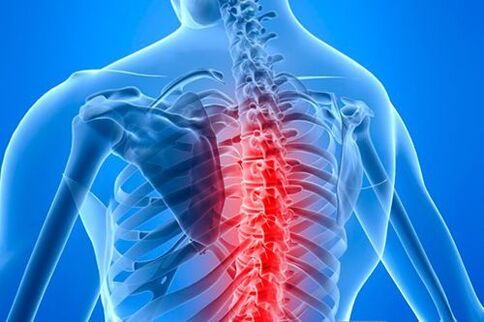 torasik osteokondroz durumunda spinal lezyon