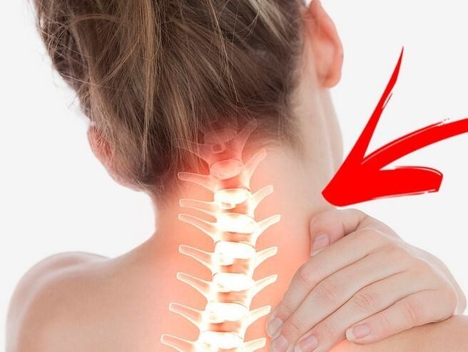 Servikal osteokondroz ile sinir köklerinin sıkışması