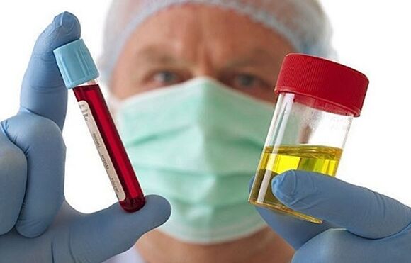 Servikal omurganın osteokondrozunu teşhis etmenin yolları