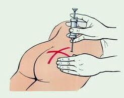 Osteokondroz tedavisi için enjeksiyon